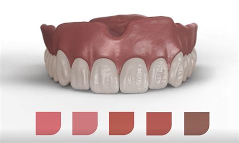 Your guide to 3d printed dentures / Dentsply Sirona USA.
